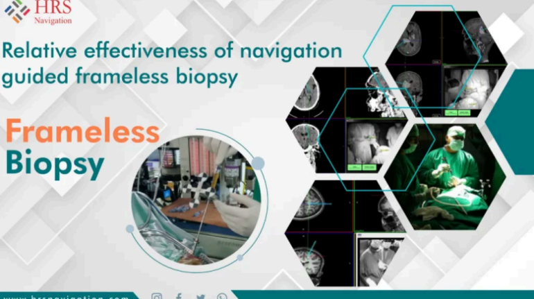 Surgical Navigation System Interface for Neurosurgery Precision