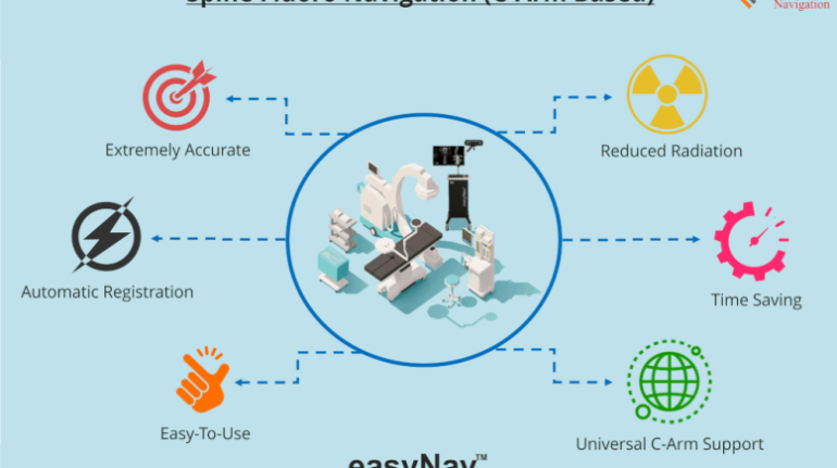 Neuronavigation System Using Optical Tracking for Brain Surgery Accuracy