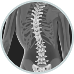 Spine Navigation System | Advanced Spine Surgery Precision 4 Group 2