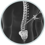 Spine Navigation System | Advanced Spine Surgery Precision 5 Group 3