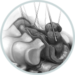 Spine Navigation System | Advanced Spine Surgery Precision 6 Group 4