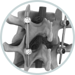 Spine Navigation System | Advanced Spine Surgery Precision 7 Group 5