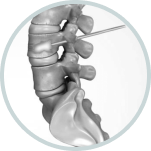 Spine Navigation System | Advanced Spine Surgery Precision 8 Group 6