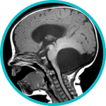 Cranial Navigation System for Image-Guided Surgery 6 Pediatric