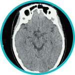 Cranial Navigation System for Image-Guided Surgery 2 Skull